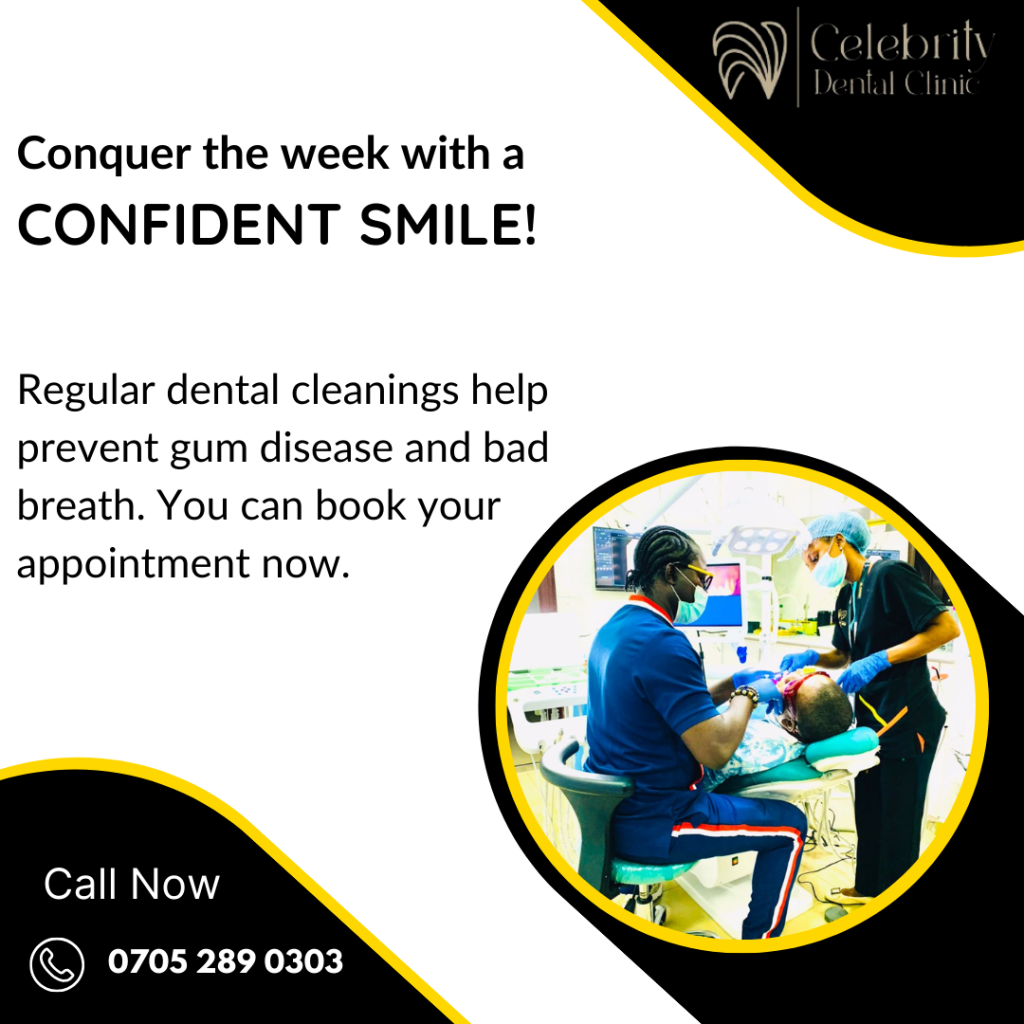 Porcelain Veneers